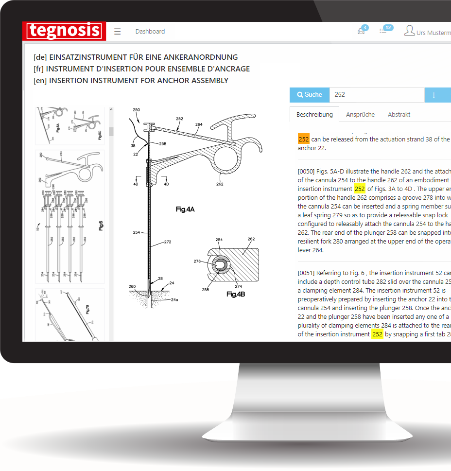 Patent analysieren - Bilder mit dem Text vergleichen, im Text suchen